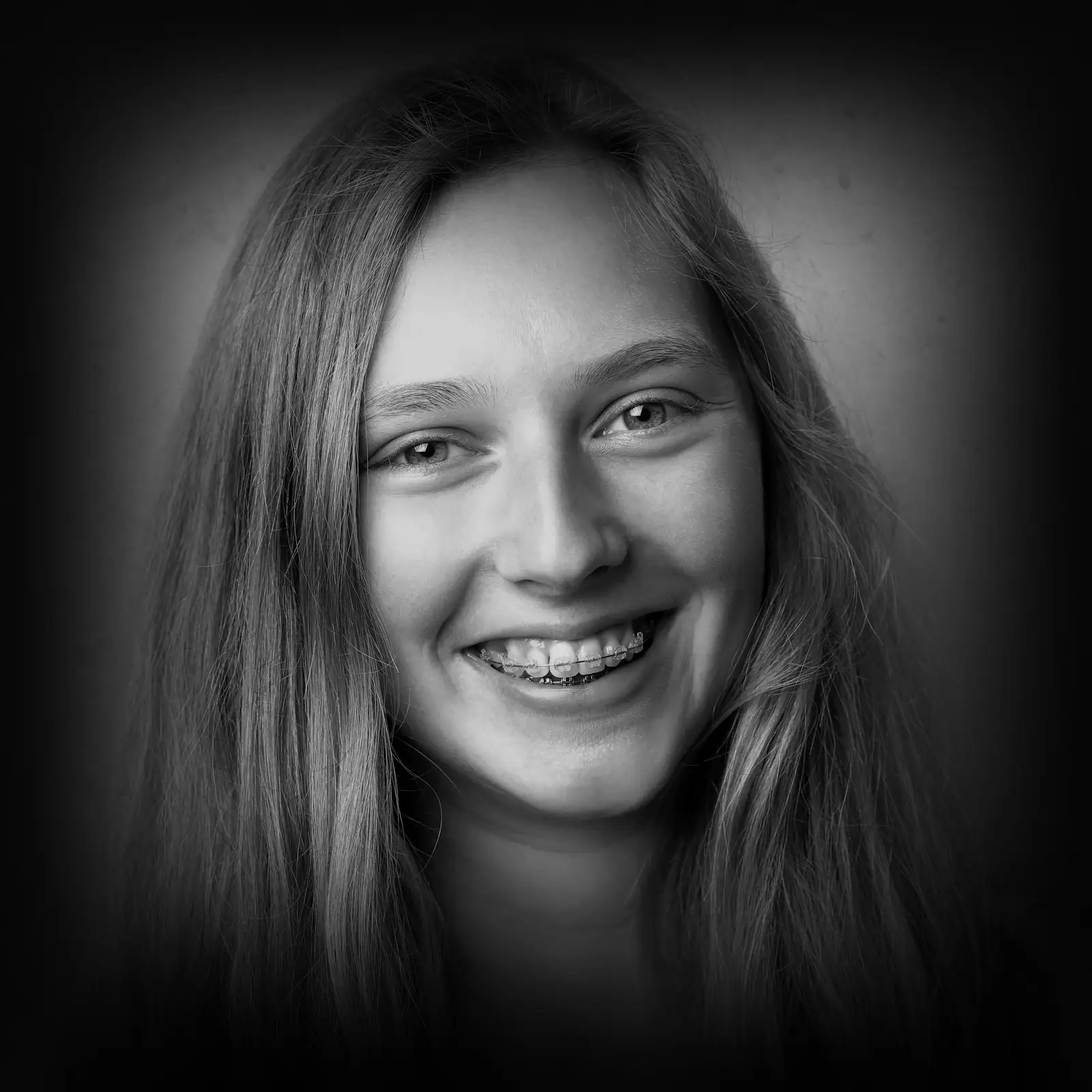 Mujer joven sonriendo con brackets, retrato en blanco y negro sobre fondo gris